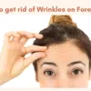 H How to get rid of wrinkles on forehead naturally