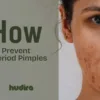 how to prevent period pimples with Hudira`s anti-acne mask