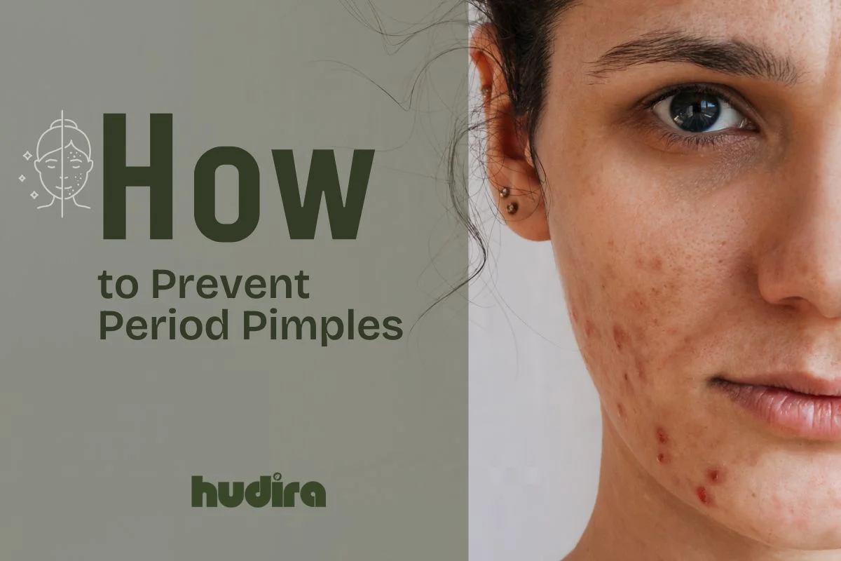 how to prevent period pimples with Hudira`s anti-acne mask