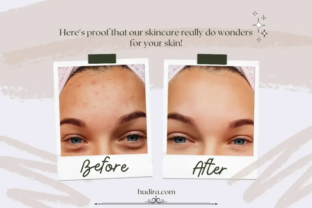 Before and After Skin Comparison after Using Natural Skin Prep Before Makeup showing clearer, smoother skin.