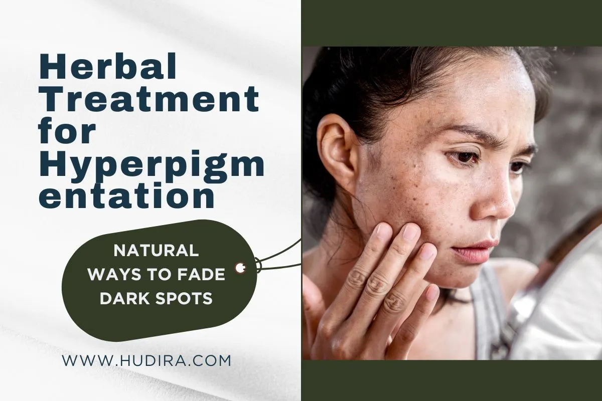 Herbal Treatment for Hyperpigmentation