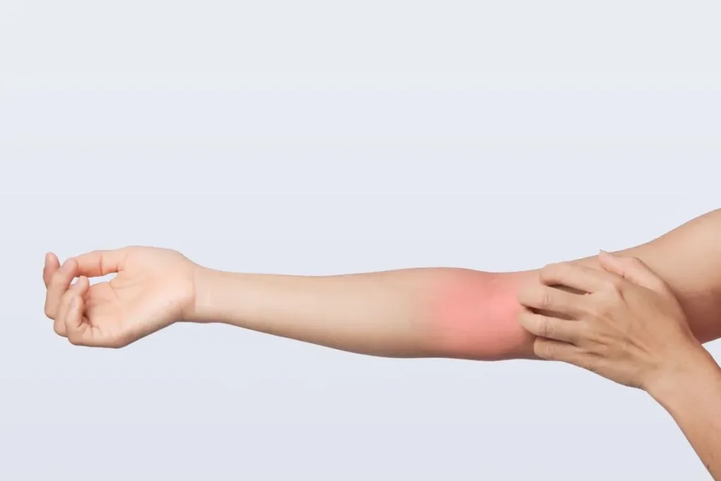 How to soothe rashes