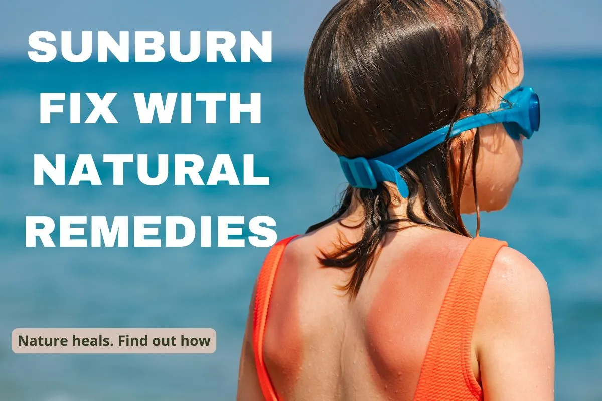 Natural sunburn remedies