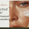 Seasonal Acne solve with natural remedies