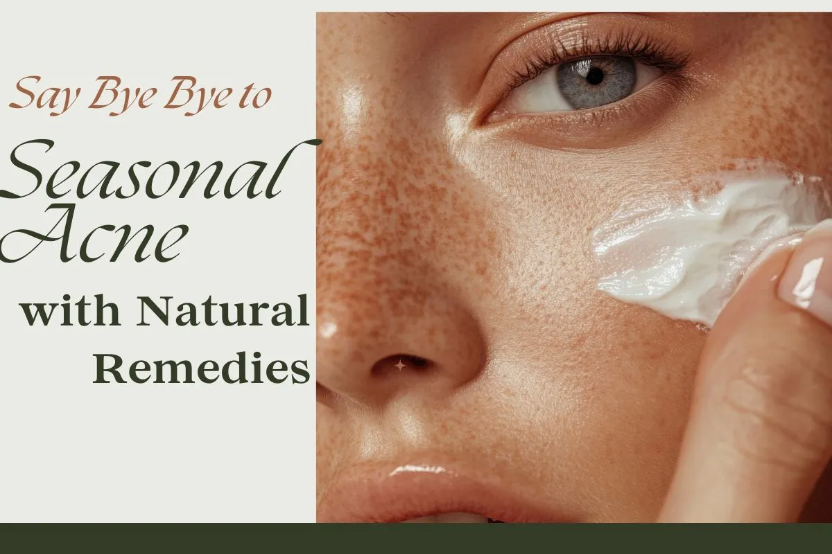Seasonal Acne solve with natural remedies