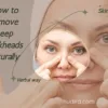 How to remove deep blackheads naturally