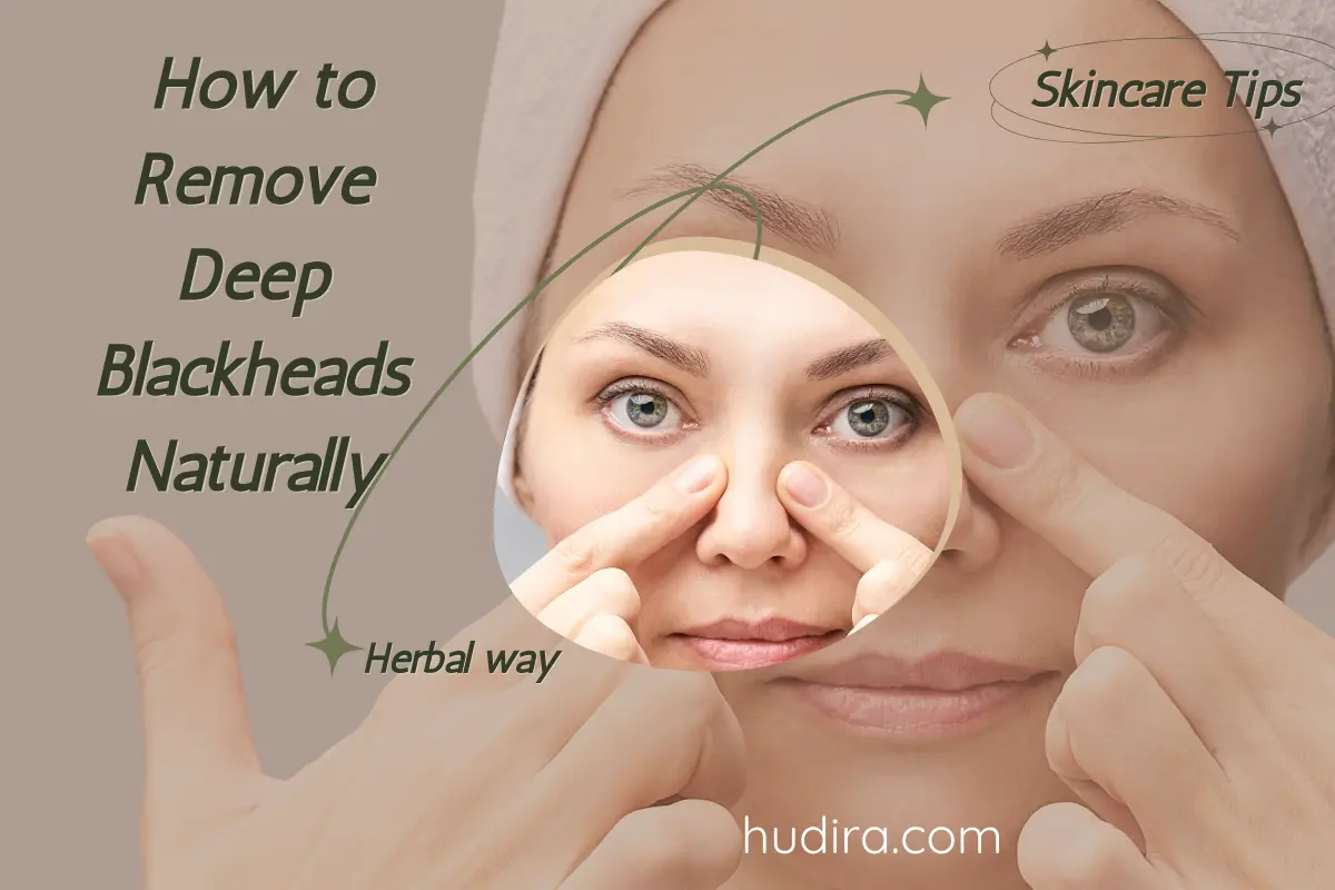 How to remove deep blackheads naturally