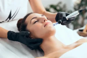 Microneedling to minimize pores