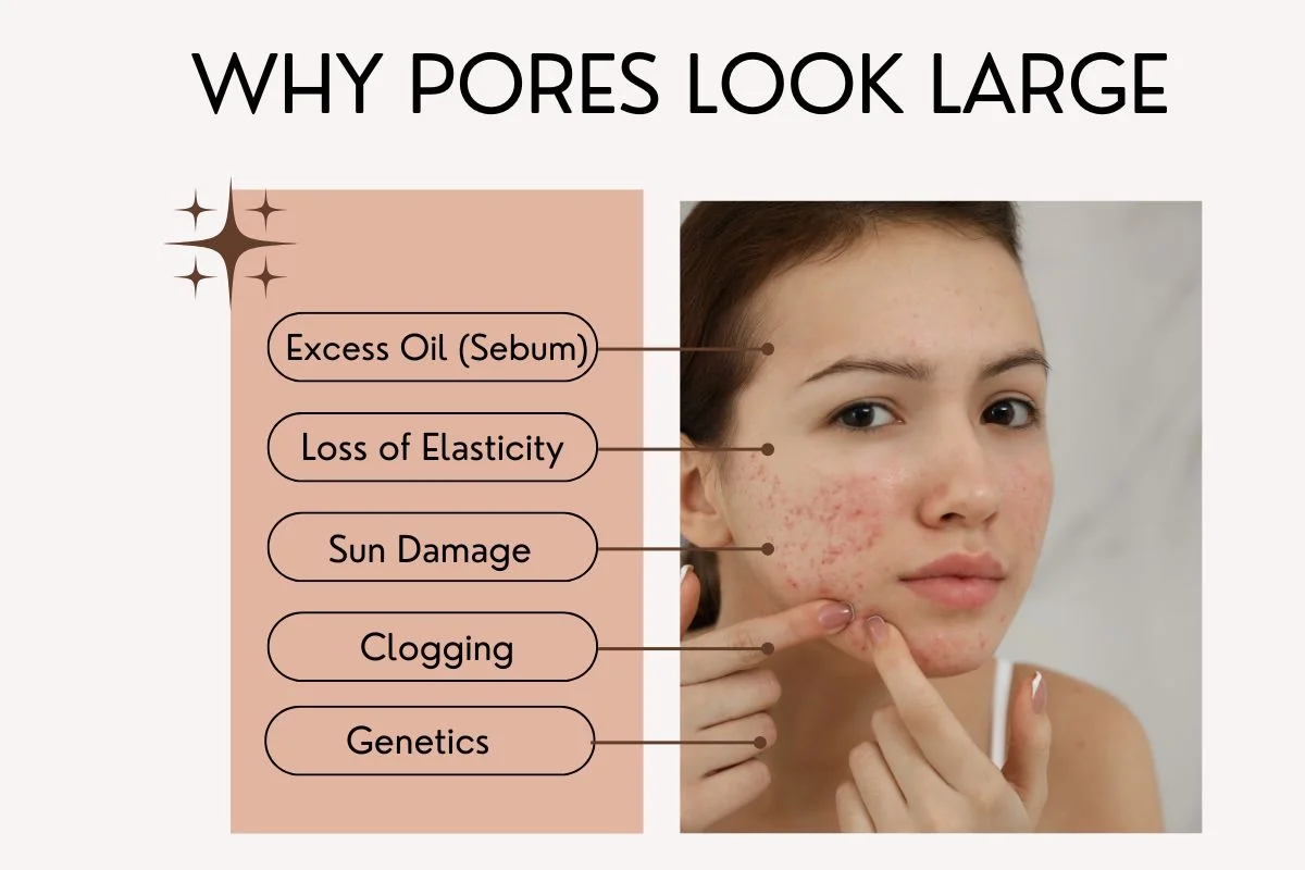Why Pores Look Large | skin pores