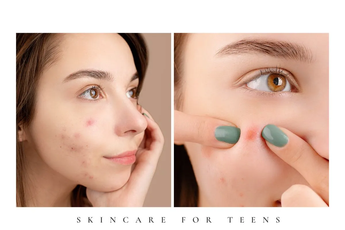 Best Skincare for Teens