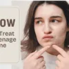 How to Treat Teenage Acne | Skincare for Teens