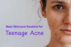 Best Skincare Routine for Teenage Acne