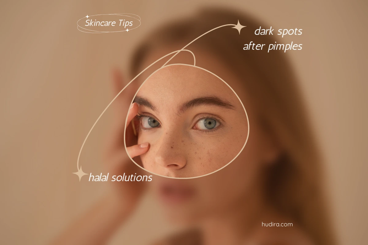 Halal Solutions for Dark Spots After Pimples