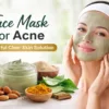 Face Mask for Acne | Anti-Acne face mask for glowing