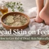How to get rid of dead skin on feet