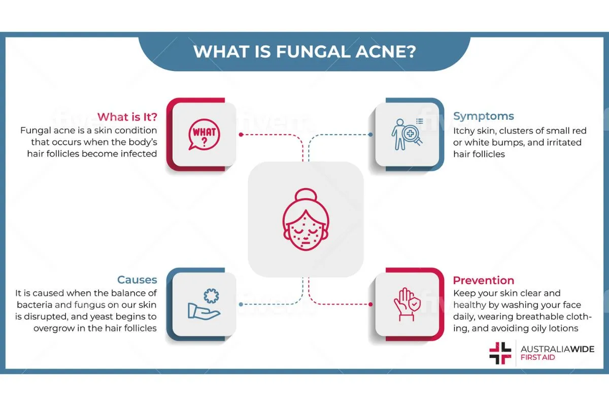 Step by step fungal acne treatment routine for face and body