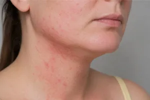 Anti inflammatory skin care products