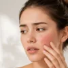Why Is There Burning on the Face after Skincare?
