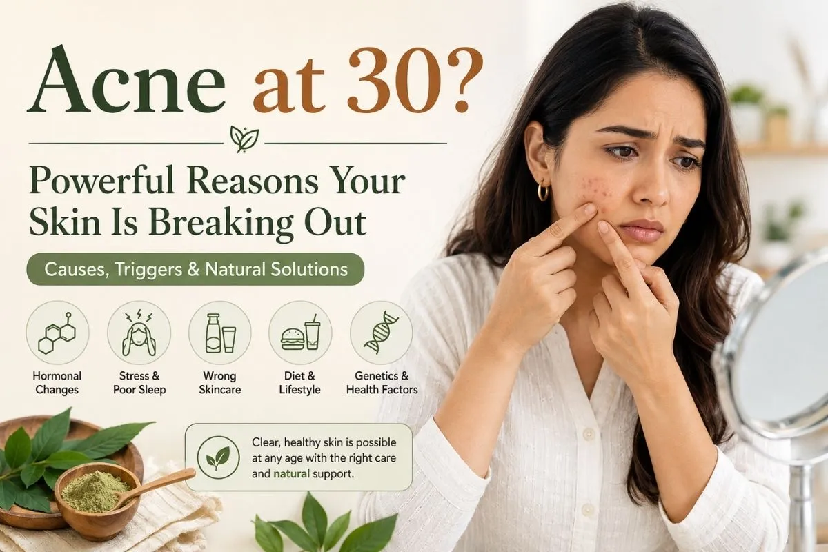 Acne at 30? Causes and Solutions | Hudira