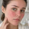 How to repair skin barrier after over-exfoliation