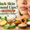 How to Remove Black Skin Around Lips? | Dark Upper Lip