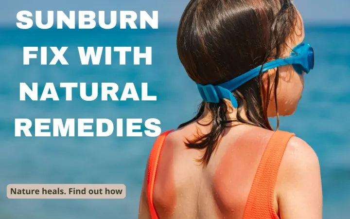 Natural sunburn remedies