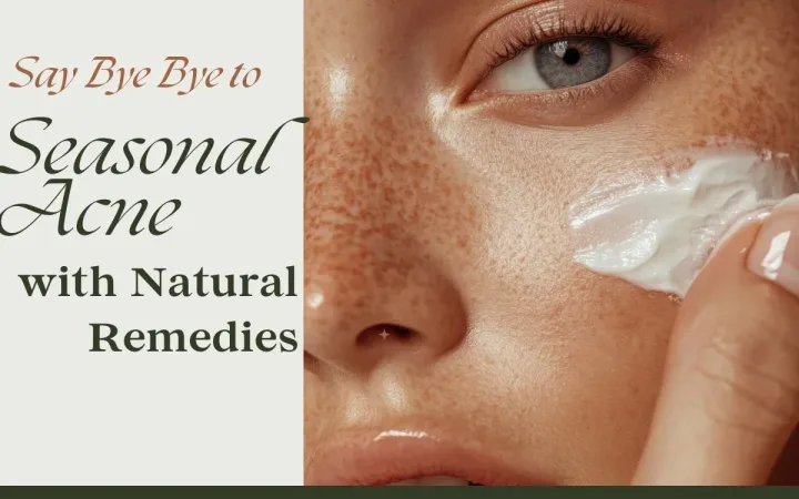 Seasonal Acne solve with natural remedies